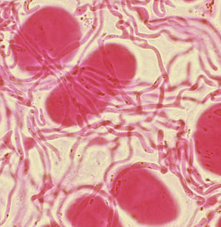 fungal hyphae